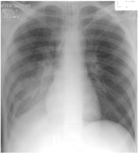 Interpretation Of The Chest Radiograph – Part 1. : WFSA - Resources