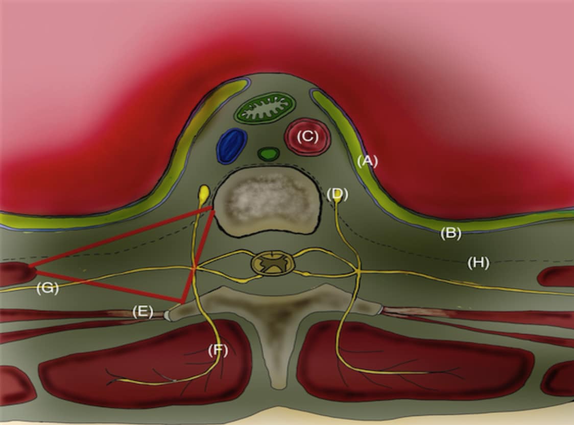 Anatomia Neuroaxial - NYSORA